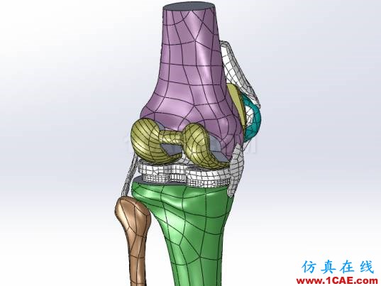 【醫(yī)學(xué)應(yīng)用】骨科知識和有限元分析ansys圖片4